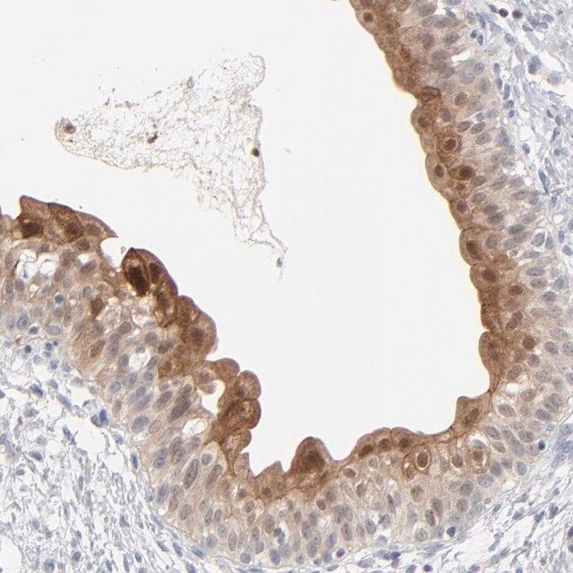 Anti-POF1B antibody produced in rabbit