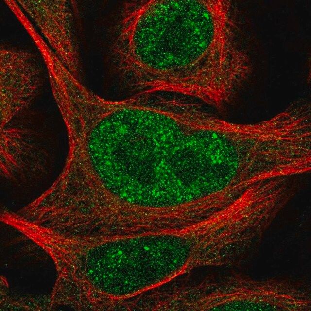 Anti-POLR3D antibody produced in rabbit