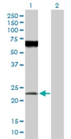 Anti-POFUT1 antibody produced in rabbit