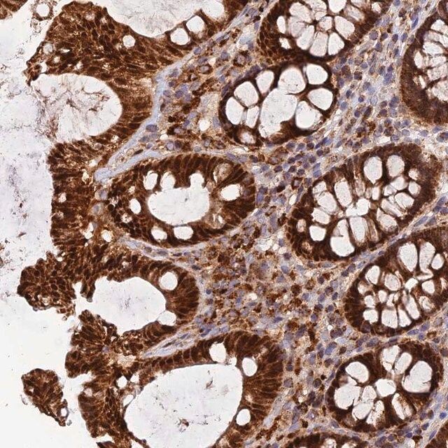 Anti-PODNL1 antibody produced in rabbit