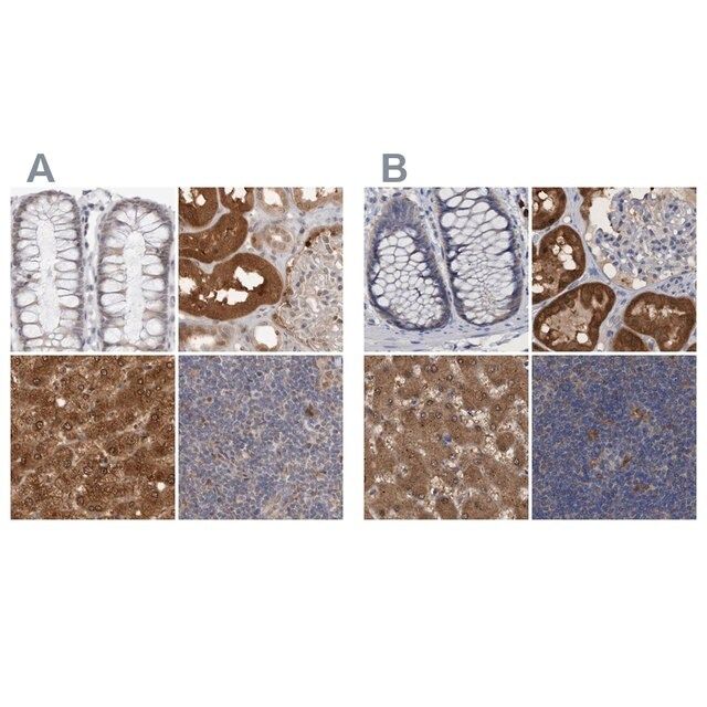 Anti-PNPO antibody produced in rabbit