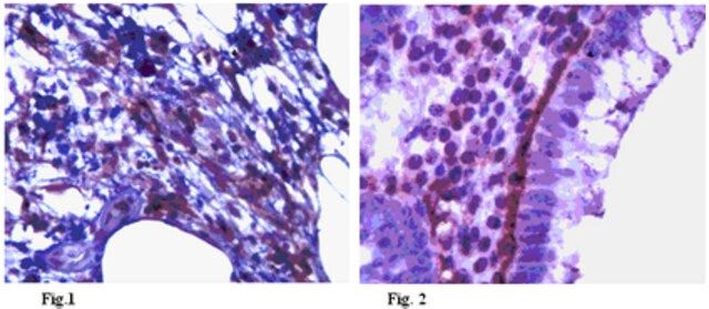 Anti-Podoplanin Antibody, clone NZ1.2