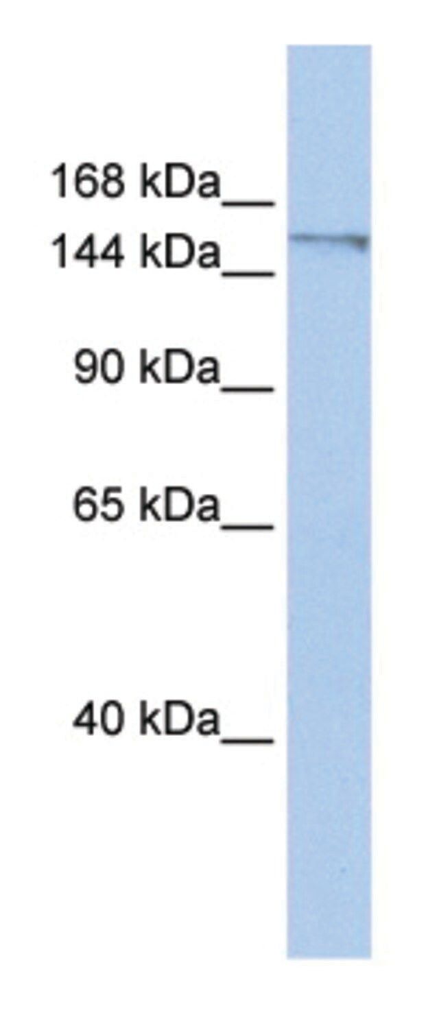 Anti-POLQ (C-terminal) antibody produced in rabbit