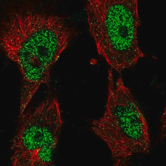 Anti-POLK antibody produced in rabbit