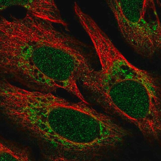 Anti-POLD4 antibody produced in rabbit