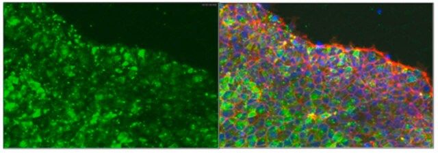 Anti-podocalyxin associated keratan sulfate, clone R-10G| MABD151 Antibody