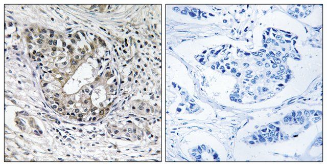 Anti-PNPT1 antibody produced in rabbit