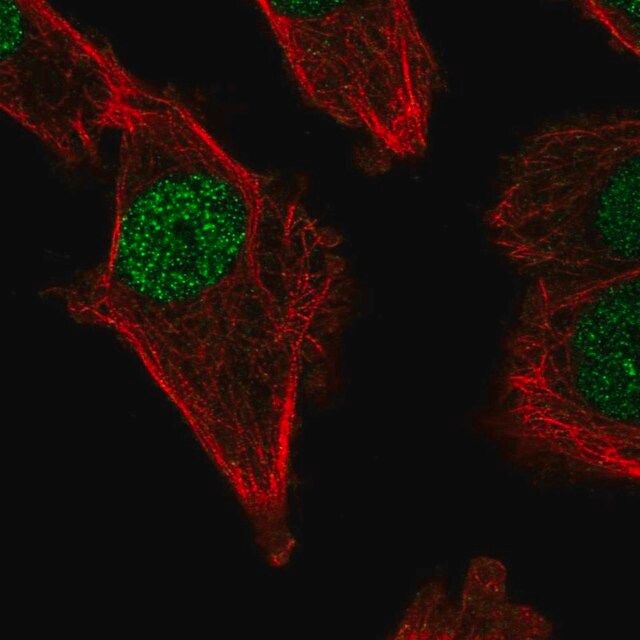 Anti-POLM antibody produced in rabbit