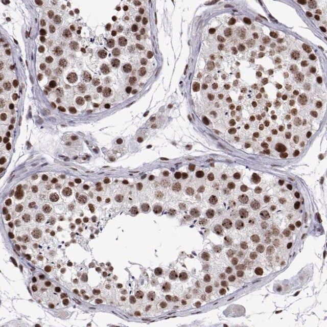 Anti-POLDIP3 antibody produced in rabbit