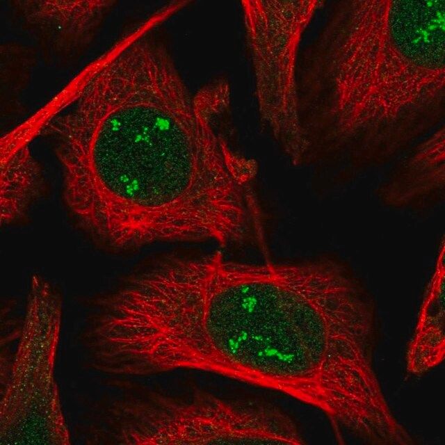 Anti-POLR1A antibody produced in rabbit