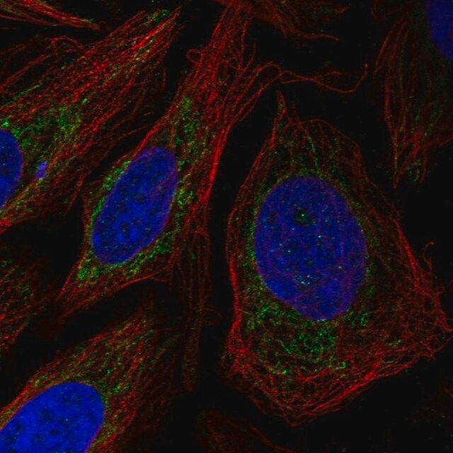 Anti-POLDIP2 antibody produced in rabbit