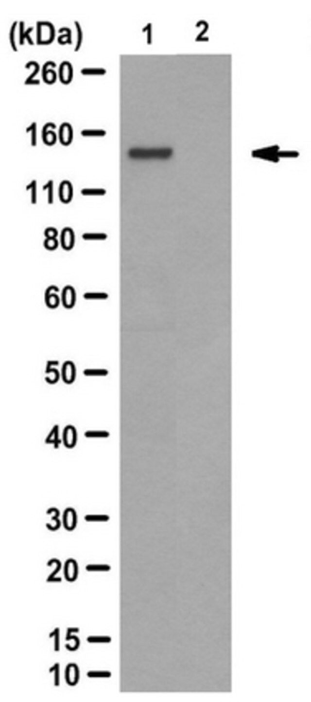 Anti-polyQ Disease Proteins Antibody, clone 3B5H10