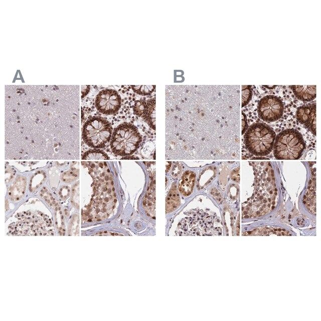 Anti-POLR2C antibody produced in rabbit