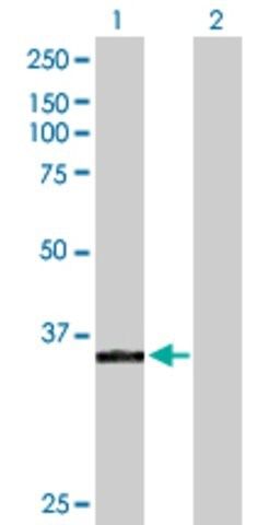 Anti-POLK antibody produced in rabbit