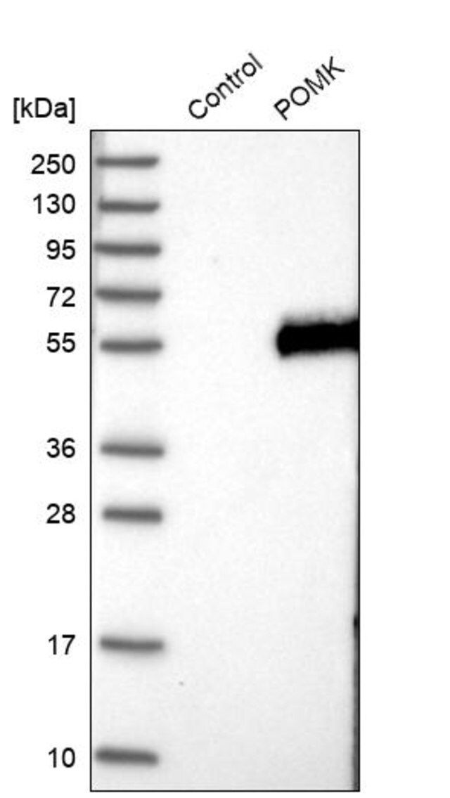 Anti-POMK antibody produced in rabbit