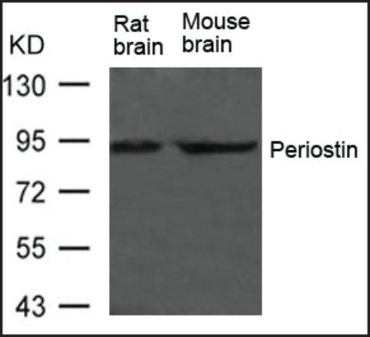 Anti-POSTN antibody produced in rabbit