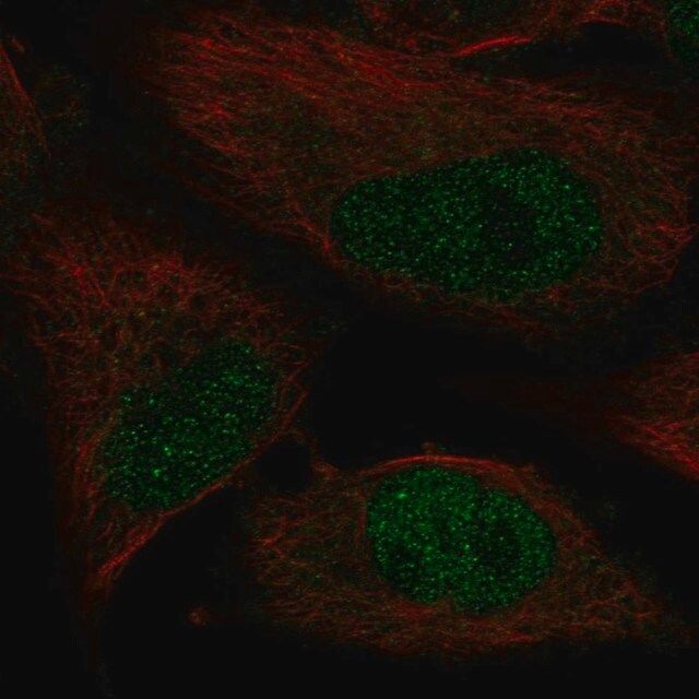 Anti-POLK antibody produced in rabbit