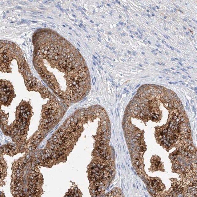 Anti-POMGNT2 antibody produced in rabbit