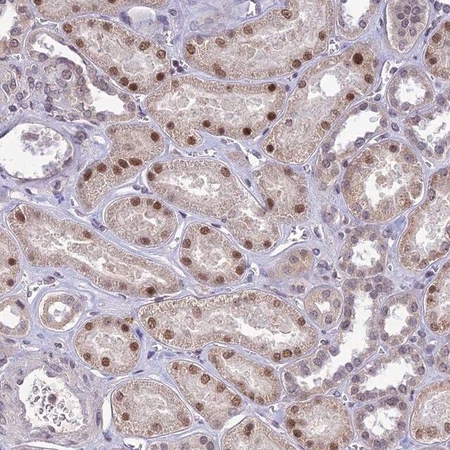 Anti-POP4 antibody produced in rabbit