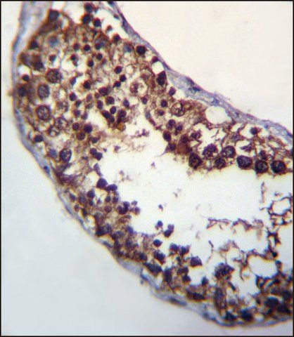 ANTI-POMT1 (C-TERM) antibody produced in rabbit