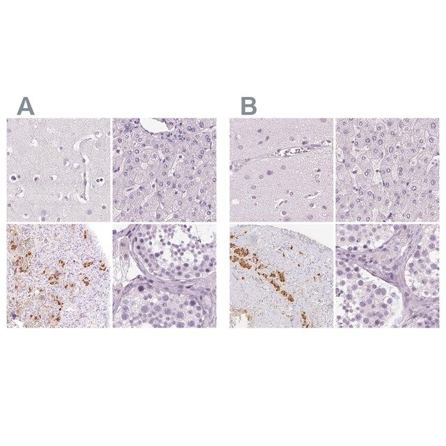 Anti-POMC antibody produced in rabbit