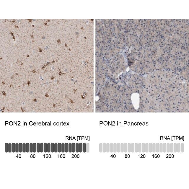 Anti-PON2 antibody produced in rabbit