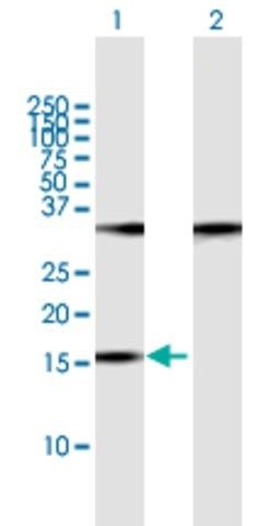 Anti-POP7 antibody produced in mouse