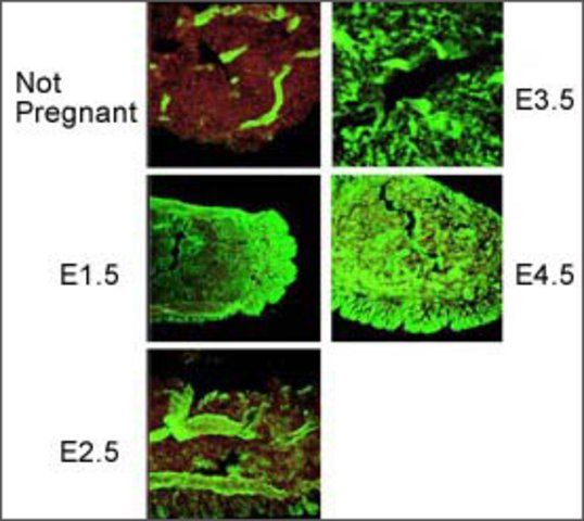 Anti-PORCN antibody produced in rabbit