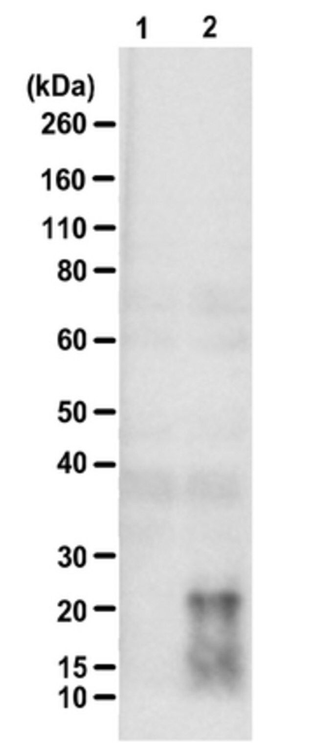 Anti-poly-(QAGR)