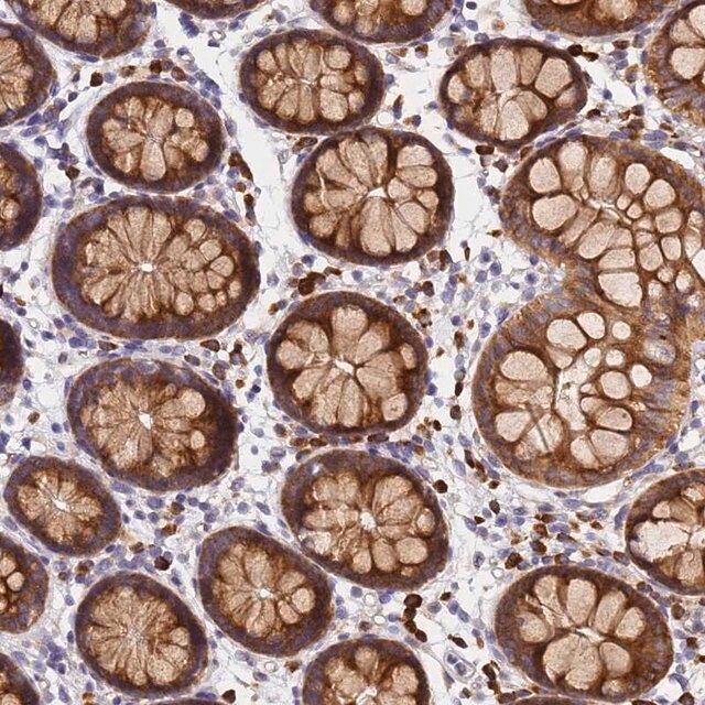 Anti-POM121 antibody produced in rabbit