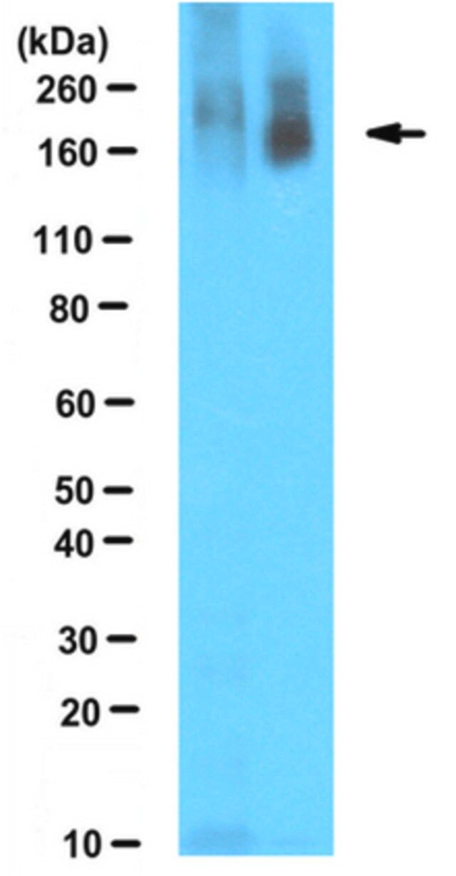 Anti-Poly ADP-ribose Antibody, clone 10H