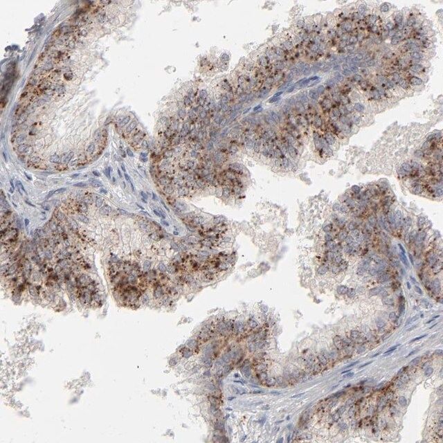 Anti-POMT2 antibody produced in rabbit