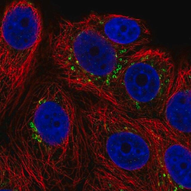 Anti-POMT1 antibody produced in rabbit