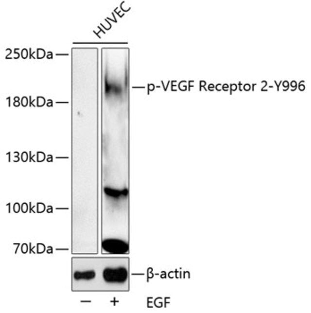 Anti-Phospho-VEGF Receptor 2-Y996 antibody produced in rabbit