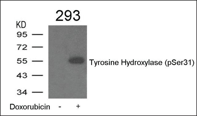 Anti-phospho-Tyrosine Hydroxylase (pSer<sup>31</sup>) antibody produced in rabbit