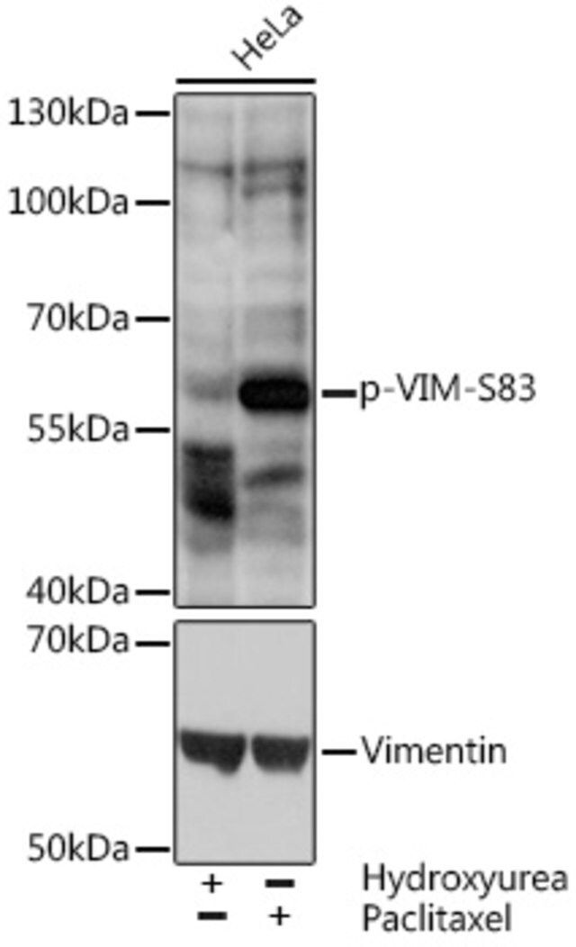 Anti-Phospho-VIM-S83 antibody produced in rabbit