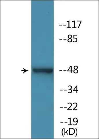 Anti-phospho-YAP (pSer<sup>127</sup>) antibody produced in rabbit