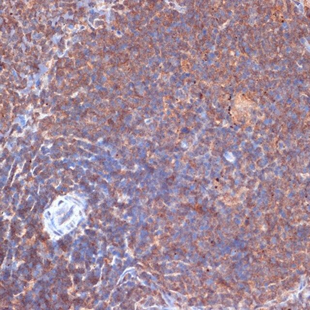 Anti-PI3 Kinase p110 delta antibody produced in rabbit