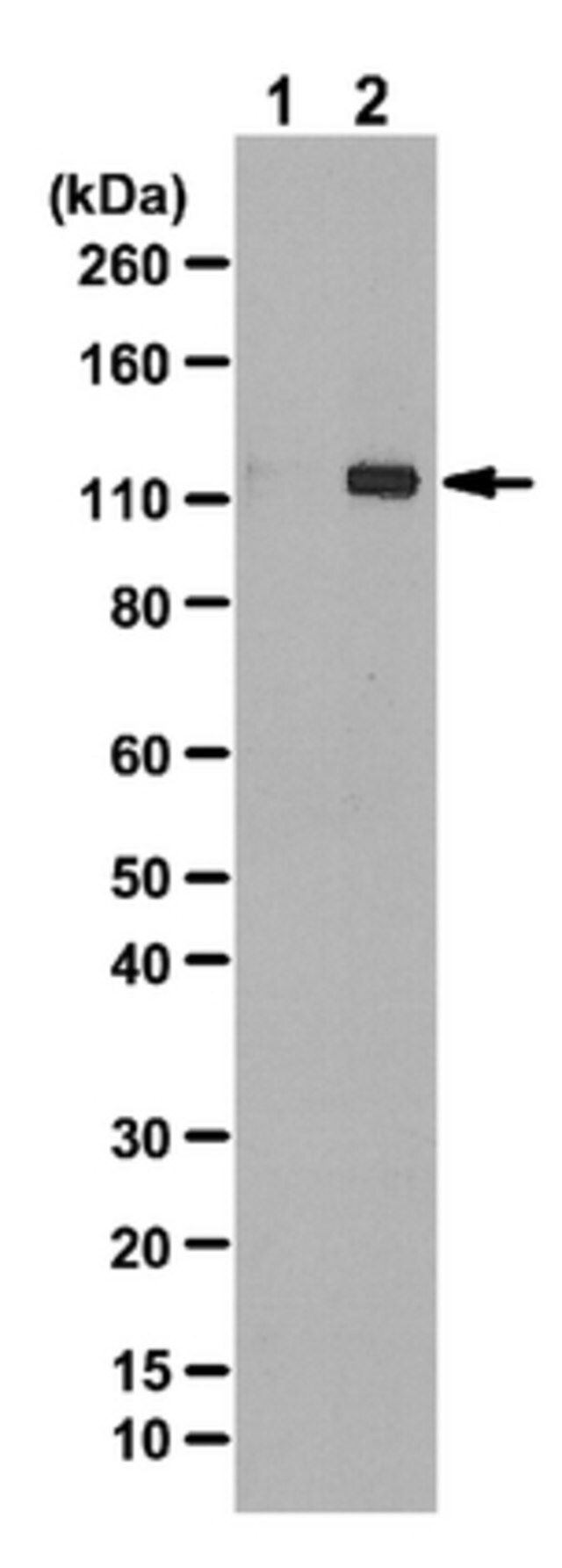 Anti-phospho-ULK1 (Ser555) Antibody