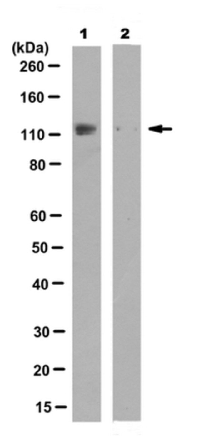 Anti-phospho-ULK1 (Ser 467), clone 15D12.3 Antibody