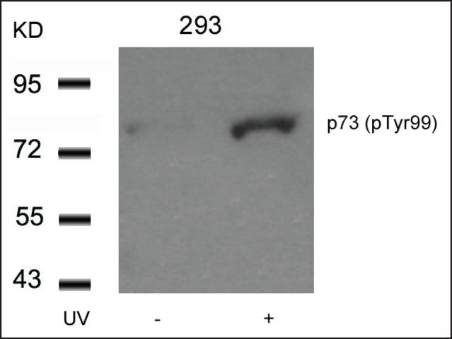 Anti-phospho-TP73 (pTyr<sup>99</sup>) antibody produced in rabbit