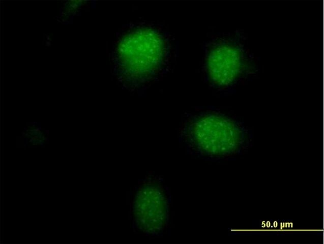 Anti-PHTF1 antibody produced in mouse