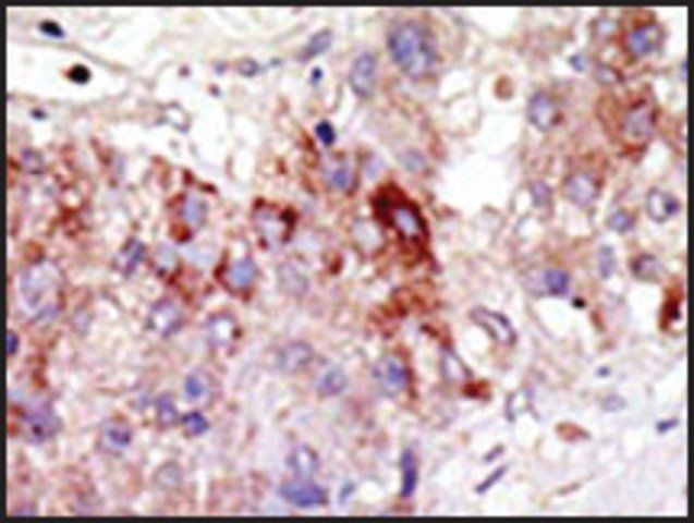 Anti-PIAS1 (N-term) antibody produced in rabbit