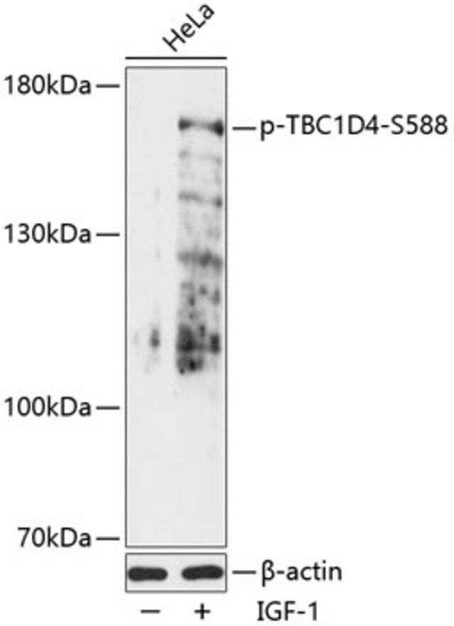 Anti-Phospho-TBC1D4-S588 antibody produced in rabbit