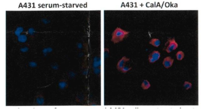 Anti-Phosphothreonine Antibody, clone RM102