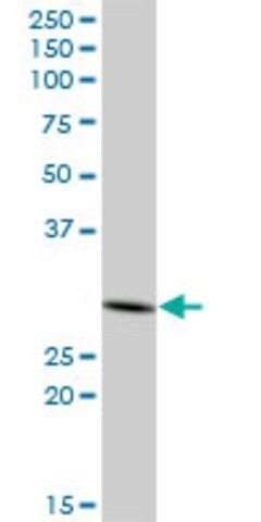 Anti-PHYHD1 antibody produced in mouse