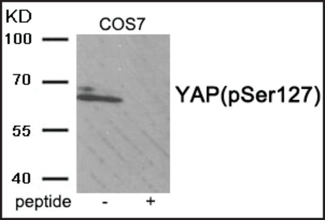 Anti-phospho-YAP (pSer<sup>127</sup>) antibody produced in rabbit