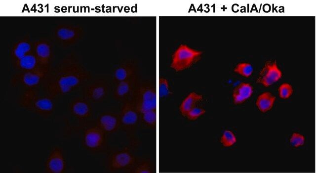 Anti-Phosphothreonine antibody, Rabbit monoclonal