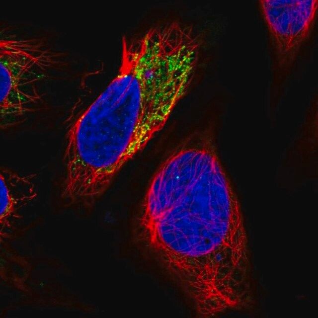 Anti-PHYKPL antibody produced in rabbit