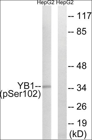 Anti-phospho-YB1 (pSer<sup>102</sup>) antibody produced in rabbit